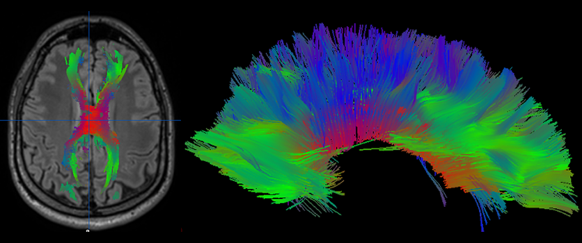 Neuroradiology Image
