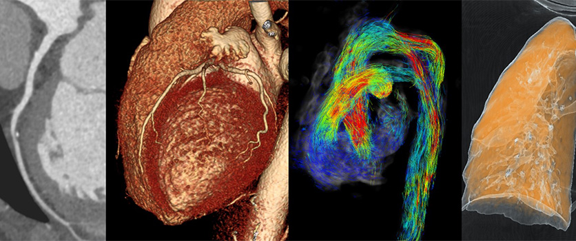 Cardiovascular and Thoracic Imaging Image