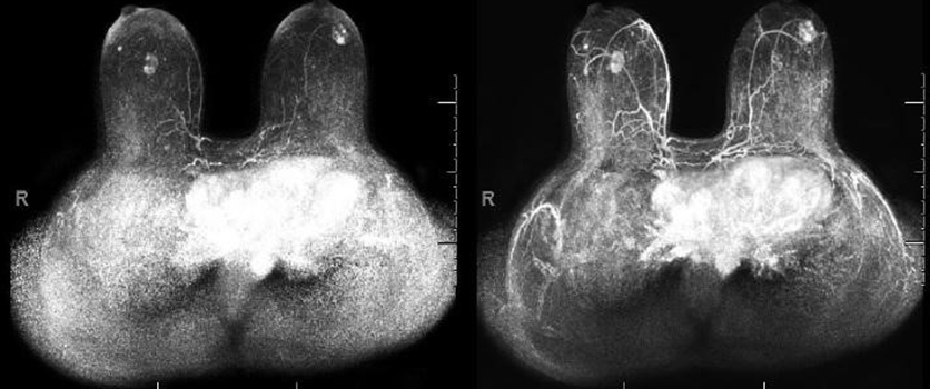Breast Imaging Image