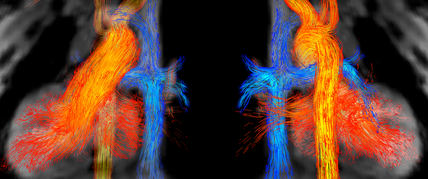 Cardiovascular & Thoracic Imaging Image