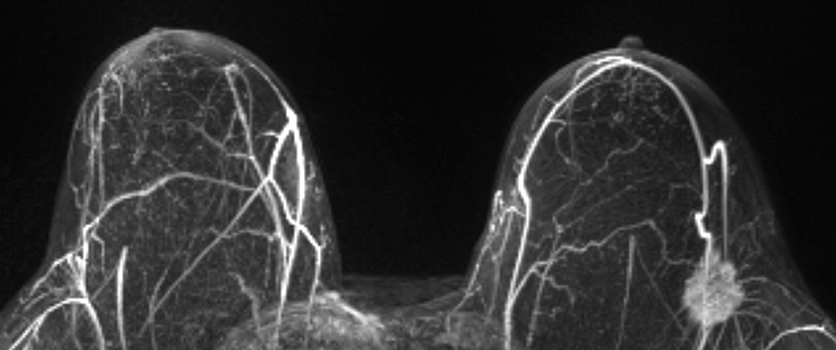 Breast Imaging Image