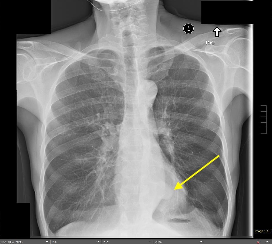 chest-angiogram.jpg