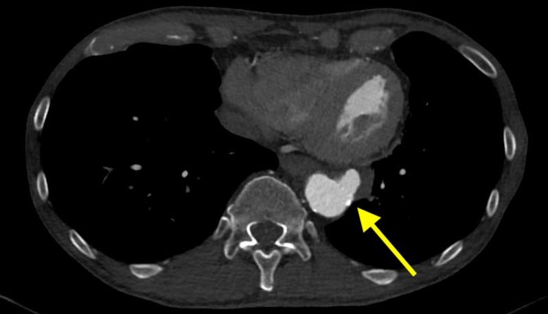 chest-angiogram_2.jpg