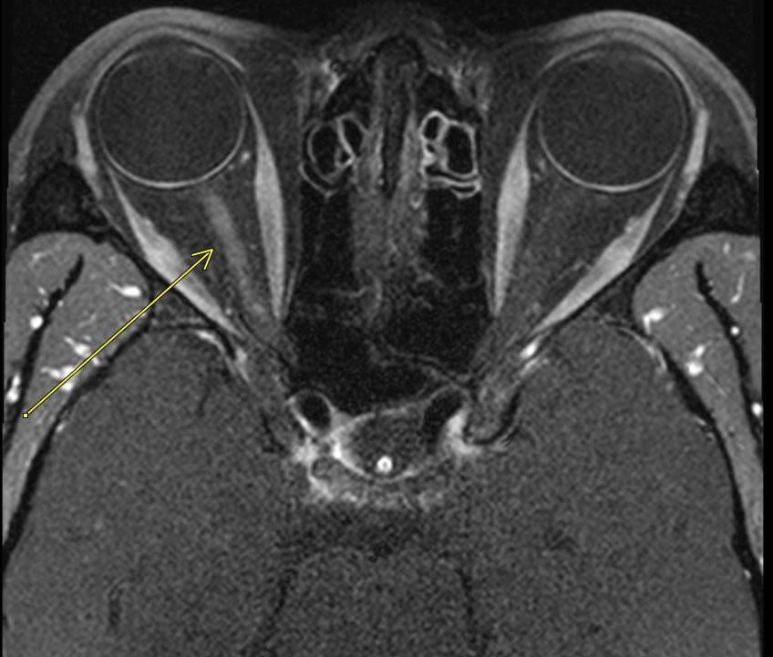 neuro_3.jpg